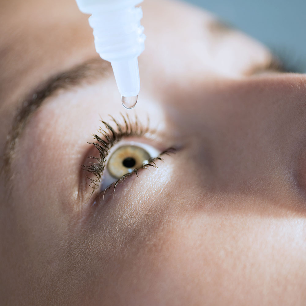 Primo piano di un occhio mentre riceve una goccia di collirio, applicato con un contagocce per la terapia del glaucoma
