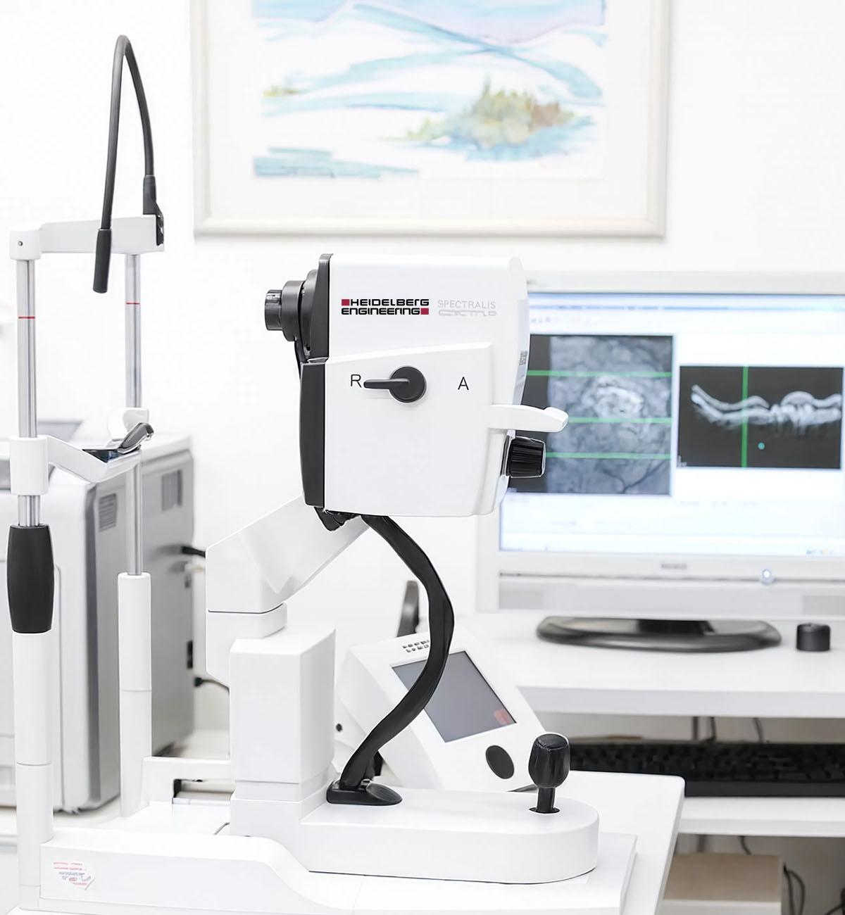 Strumento OCT Heidelberg Engineering Spectralis in studio oculistico, con scansione della retina visibile a monitor